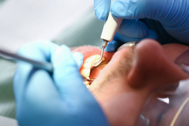 Best Emergency Dental Care for Broken or Chipped Teeth in Windermere, FL